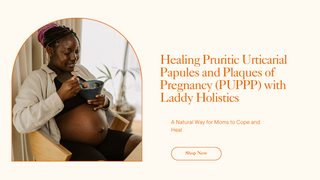 Healing Pruritic Urticarial Papules and Plaques of Pregnancy (PUPPP) with Laddy Holistics