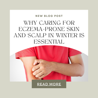 Why Caring for Eczema-Prone Skin and Scalp in Winter is Essential